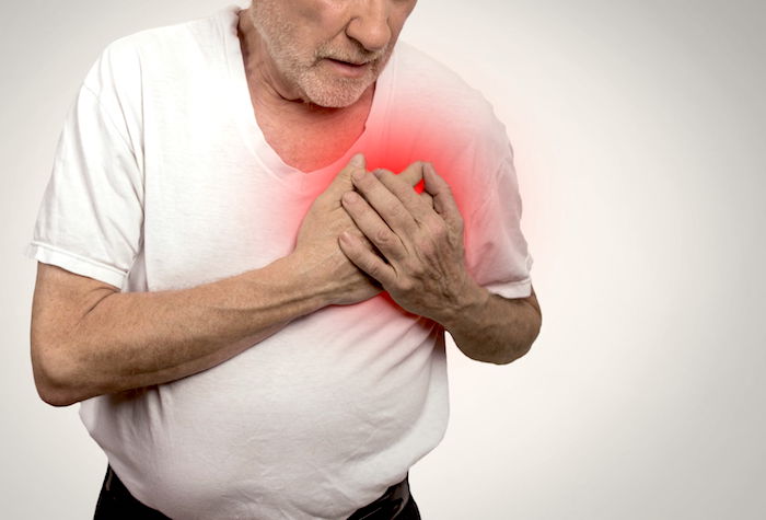 Complicaciones del infarto de miocardio