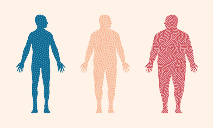 ¿Cuál es la diferencia entre ser obeso y ser clínicamente obeso?