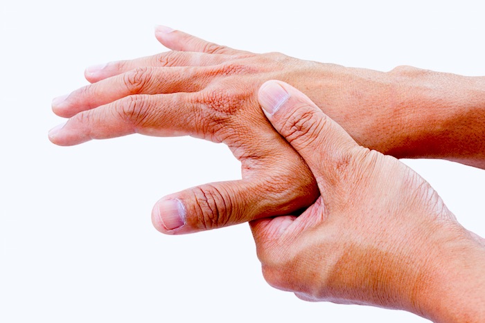 Existe una cura para la artritis reumatoide