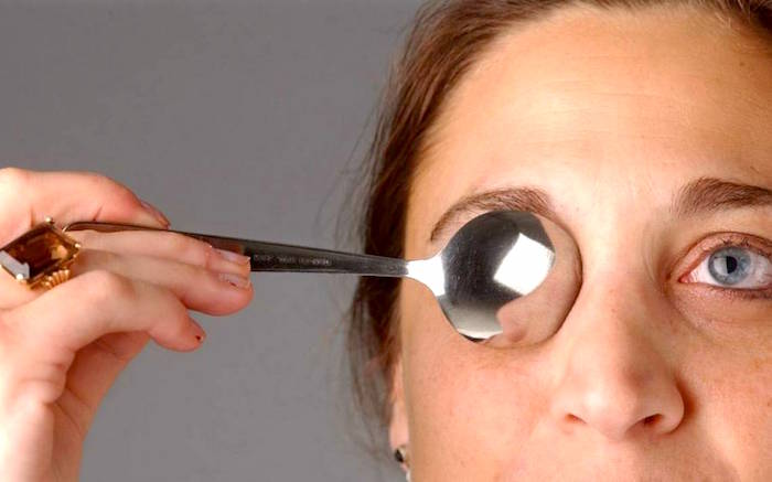 Cirugía ocular para ojos hinchados