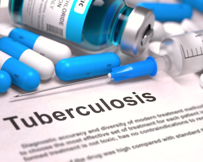 Causas de la tuberculosis