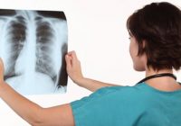 EPOC es una enfermedad pulmonar crónica