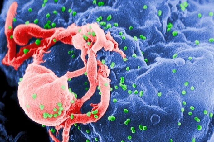 Algunas personas infectadas con el VIH son resistentes al virus. Ahora los científicos piensan que podrían saber el porqué