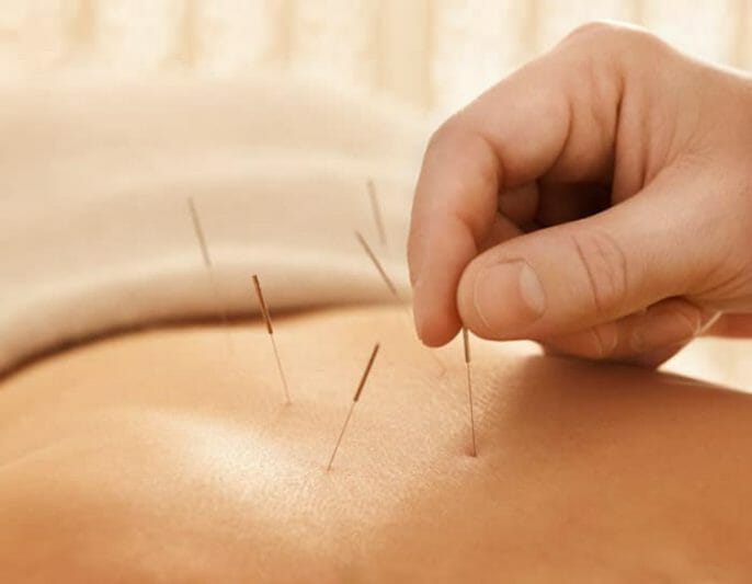 ¿Cómo puede la acupuntura ayudar cuando se trata de concebir?