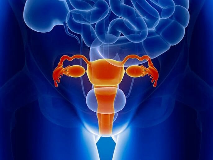 Cáncer de ovario: Causas, factores de riesgo, síntomas, tratamiento y prevención