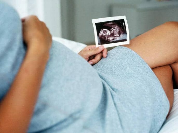 Síndrome de Down: Cribado prenatal durante el embarazo