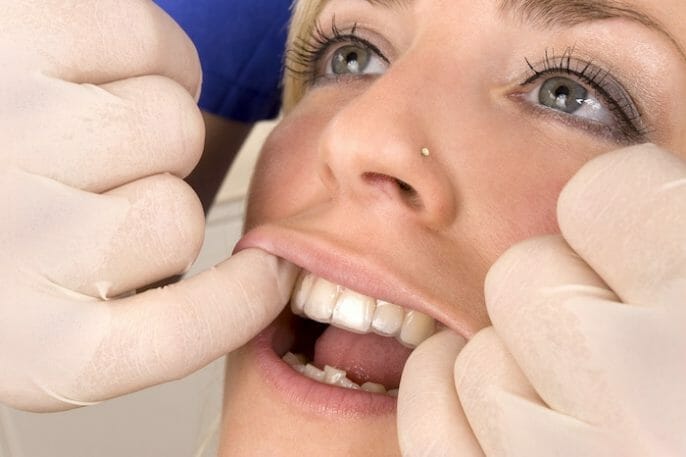¿Por qué los dientes vuelven a torcerse después del tratamiento ortodóncico? ¿Cómo puede ser prevenido?