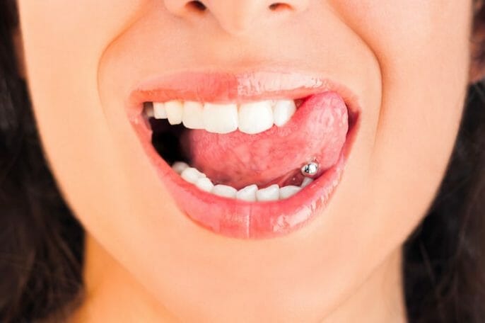 Complicaciones de una perforación de la lengua