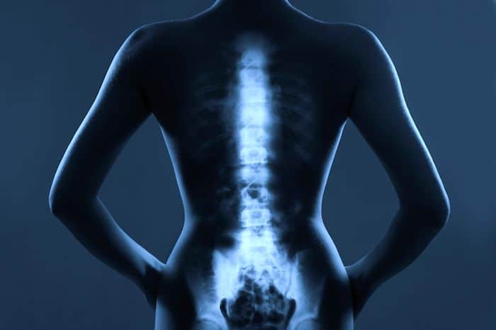 El impacto que el dolor de espalda tiene en la salud mental