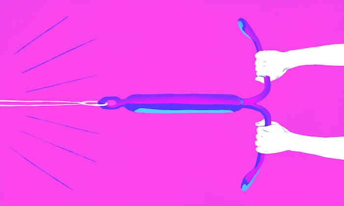 Control de la natalidad a largo plazo: ¿es el dispositivo intrauterino (DIU) el método anticonceptivo adecuado para usted?