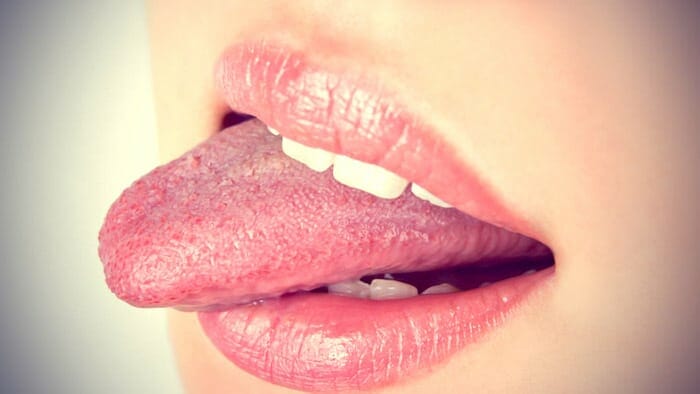 Dolor y malestar en la lengua
