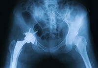 Mejores aplicaciones médicas para el uso en la salud ortopédica