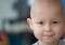 Leucemia linfocítica aguda en niños: tratamiento convencional