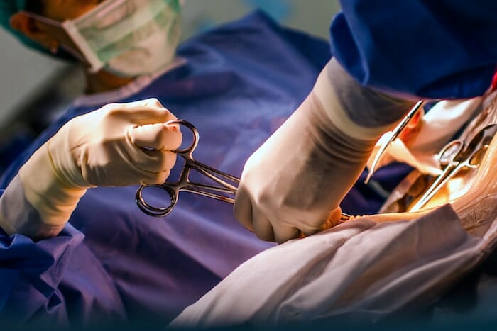 La longitud de la incisión puede afectar el dolor después del parto por cesárea