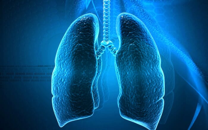 Expectativas para el tratamiento del cáncer de pulmón