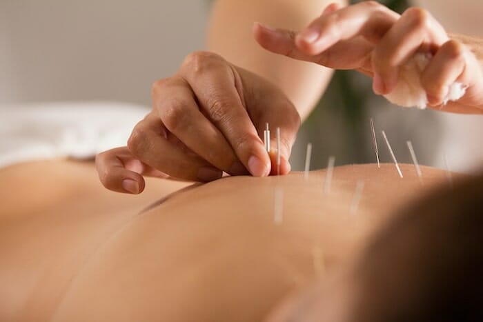 La fisioterapia, la terapia de masaje y la acupuntura