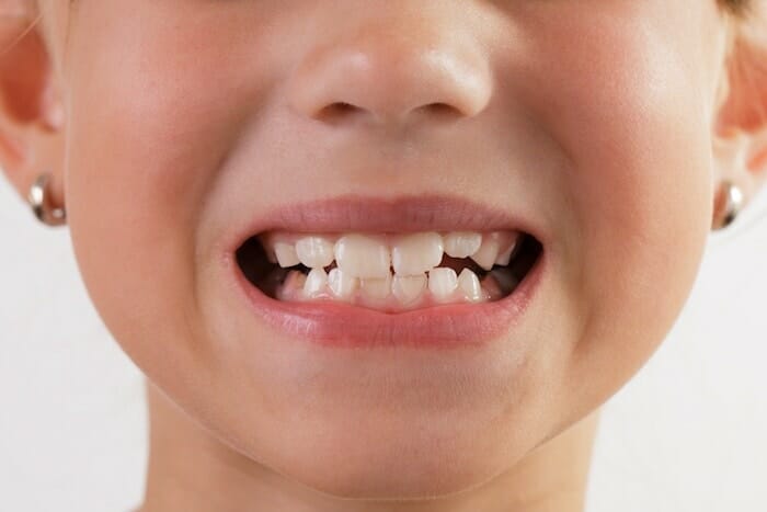 Cinco conceptos erróneos comunes sobre la dentición