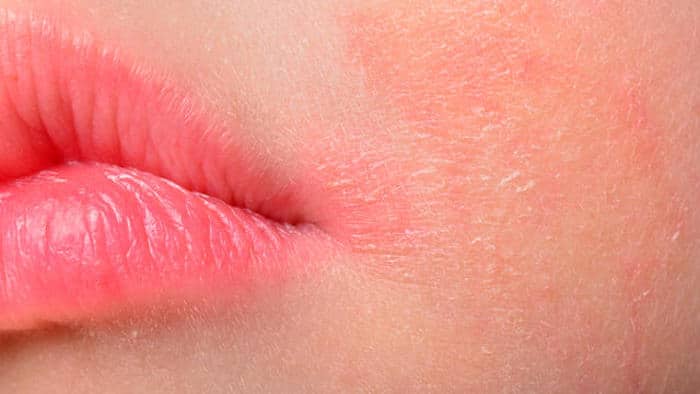 El picazón en la piel por estrés pueden tener algunas causas totalmente inesperadas