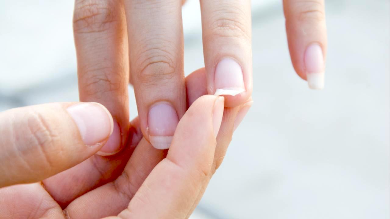 Lo que tus uñas pueden contarte sobre tu salud