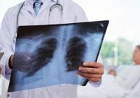 No puede respirar: ¿tiene bronquitis aguda y necesita ver a un médico?
