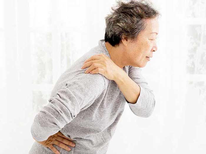 La artritis comúnmente afecta los hombros en personas que también tienen lupus
