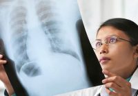 ¿Qué podría ayudar a tratar las densidades sospechosas en mis pulmones?