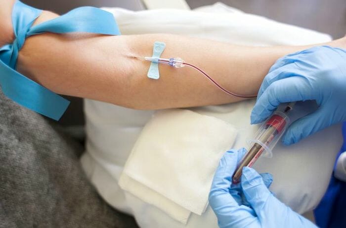 Una prueba de gasometría arterial permite a los médicos medir los niveles de oxígeno en la sangre