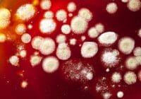 ¿Cómo tratar una infección por hongos en el pene?