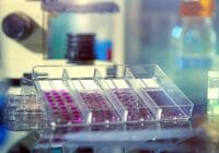 Una nueva investigación encuentra una manera de abordar las células cancerosas resistentes al tratamiento