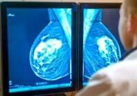 ¿Cómo se relaciona el tamaño del tumor con la etapa del cáncer de seno?
